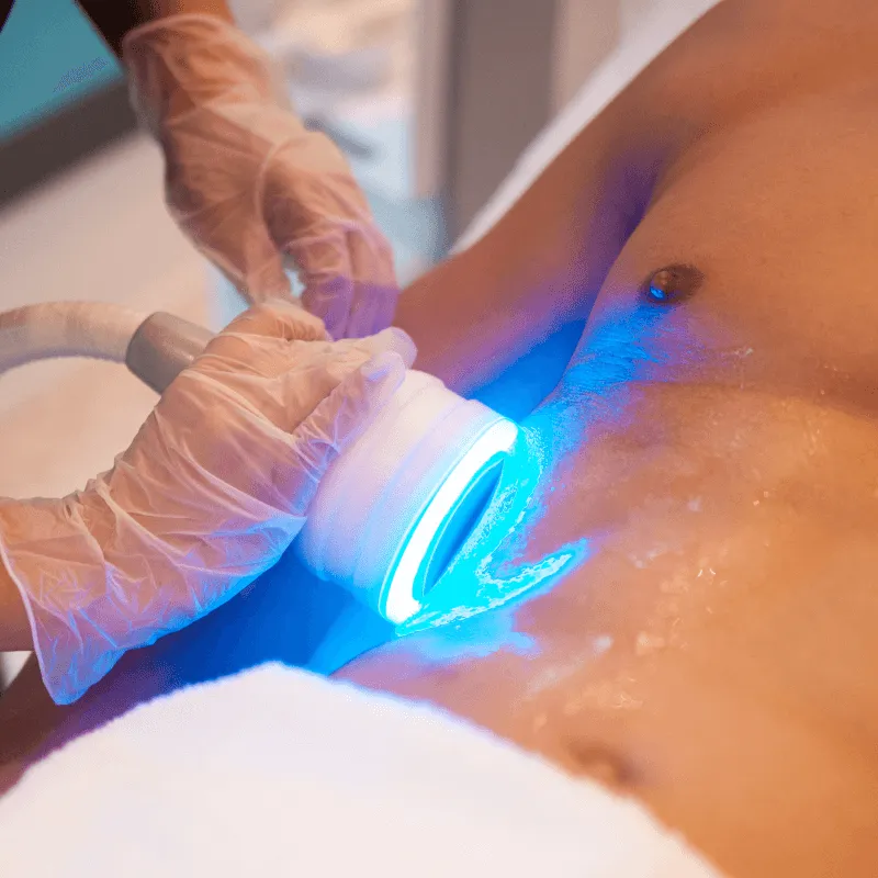 °Cryo Muscle Toning