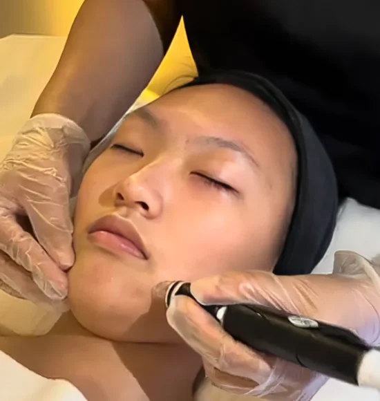 Hydrafacial